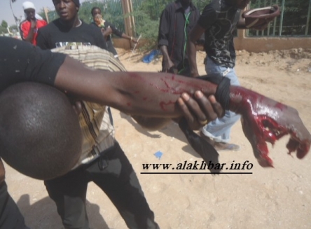 أحد المصابين في مواجهات لاتلمس جنسيتي والشرطة (الأخبار)